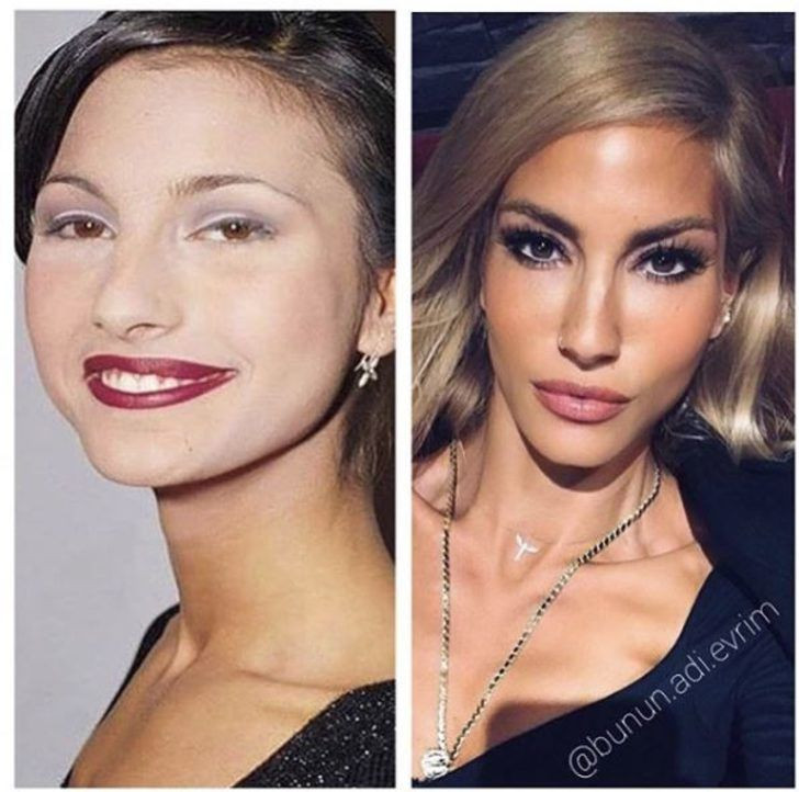 Yıllar önceki fotoğraflarını görenler tanıyamıyor! - Sayfa 14