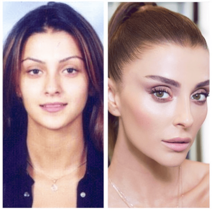 Yıllar önceki fotoğraflarını görenler tanıyamıyor! - Sayfa 17