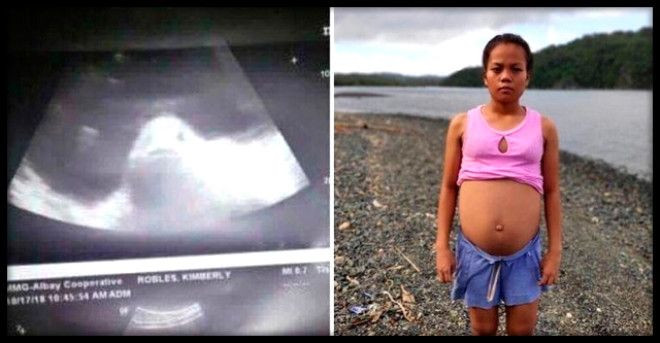 Genç kız balıkla cinsel ilişkiye girmekle suçlandı - Sayfa 6