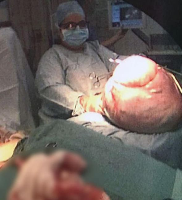 Karnından çıkan şoke etti! - Sayfa 5