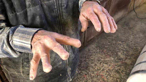 72 yıllık mesleği ellerini bu hale getirdi! - Sayfa 5