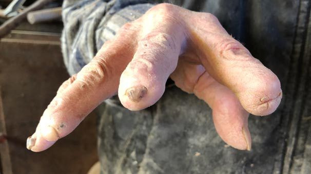 72 yıllık mesleği ellerini bu hale getirdi! - Sayfa 6