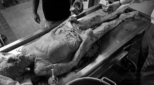 27 bin dilime ayrılmak için gönüllü oldu! - Sayfa 10