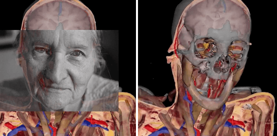 27 bin dilime ayrılmak için gönüllü oldu! - Sayfa 11