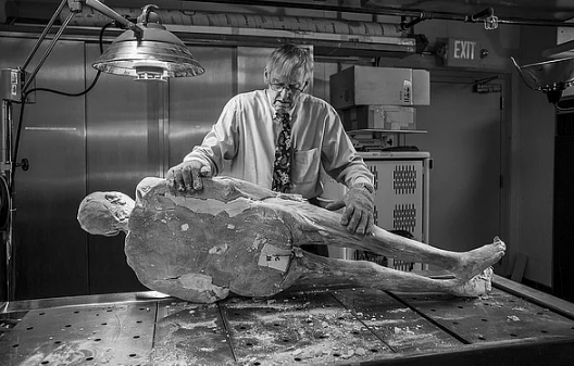 27 bin dilime ayrılmak için gönüllü oldu! - Sayfa 5