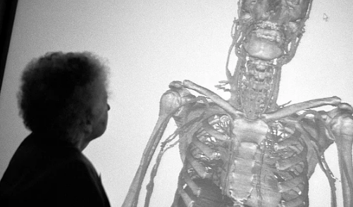 27 bin dilime ayrılmak için gönüllü oldu! - Sayfa 6