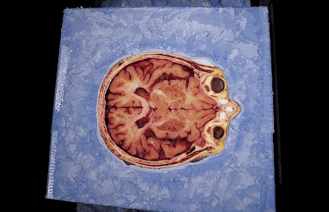 27 bin dilime ayrılmak için gönüllü oldu! - Sayfa 9