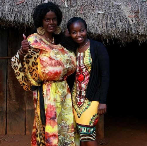 Koyu cilt bağımlısıydı! Siyahi olmaya karar verdi - Sayfa 12