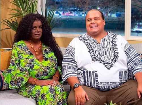 Koyu cilt bağımlısıydı! Siyahi olmaya karar verdi - Sayfa 6