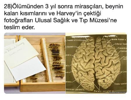 En büyük bilim hırsızı Einstein'ın beynini çaldı! - Sayfa 29