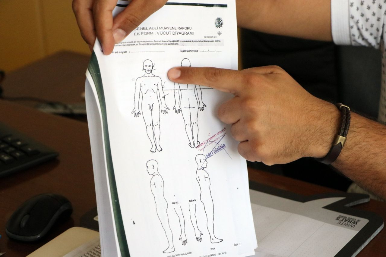 3 yaşındaki çocuğa kabusu yaşattılar! - Sayfa 6