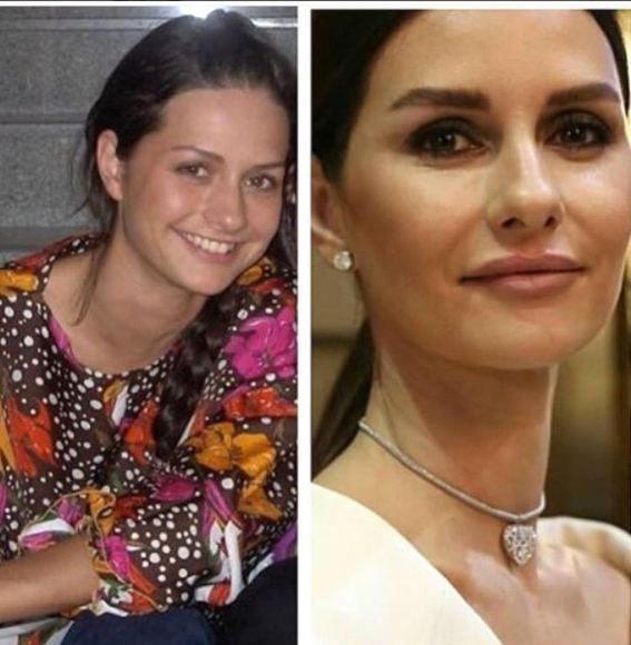 Estetik operasyonlarıyla bambaşka birine dönüştüler! - Sayfa 9