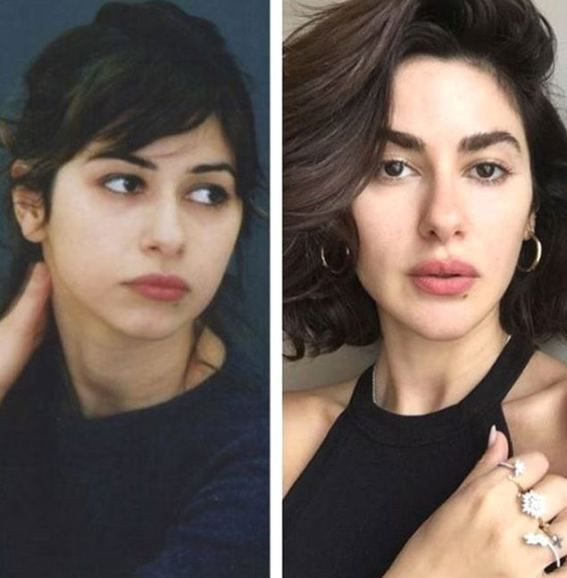 Estetik operasyonlarıyla bambaşka birine dönüştüler! - Sayfa 17