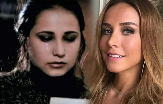 Estetik operasyonlarıyla bambaşka birine dönüştüler! - Sayfa 29