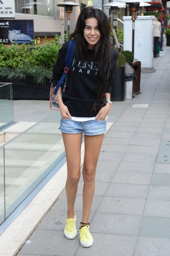 Estetik operasyonlarıyla bambaşka birine dönüştüler! - Sayfa 39