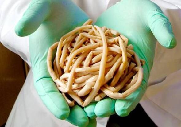 Dünyanın en ölümcül canlıları onlar! - Sayfa 32