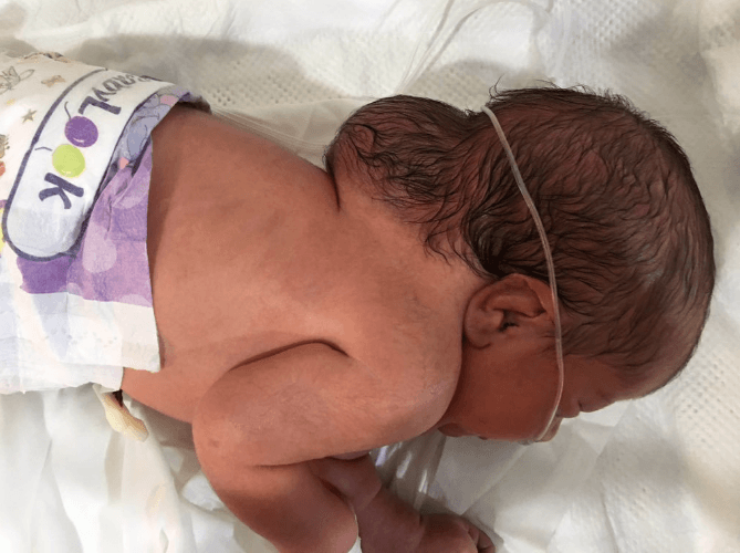 Kimyasal silahlar kusurlu doğumlara neden oldu! - Sayfa 5