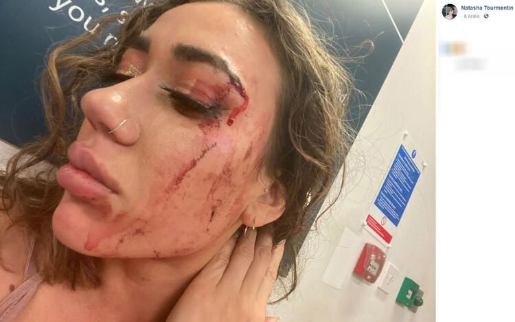 Doğum günü kabusu! Eli yüzü kan içinde kaldı... - Sayfa 12