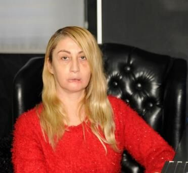 Güzellik uğruna alt dudağını kaybetti! Kötü haber geldi... - Sayfa 14