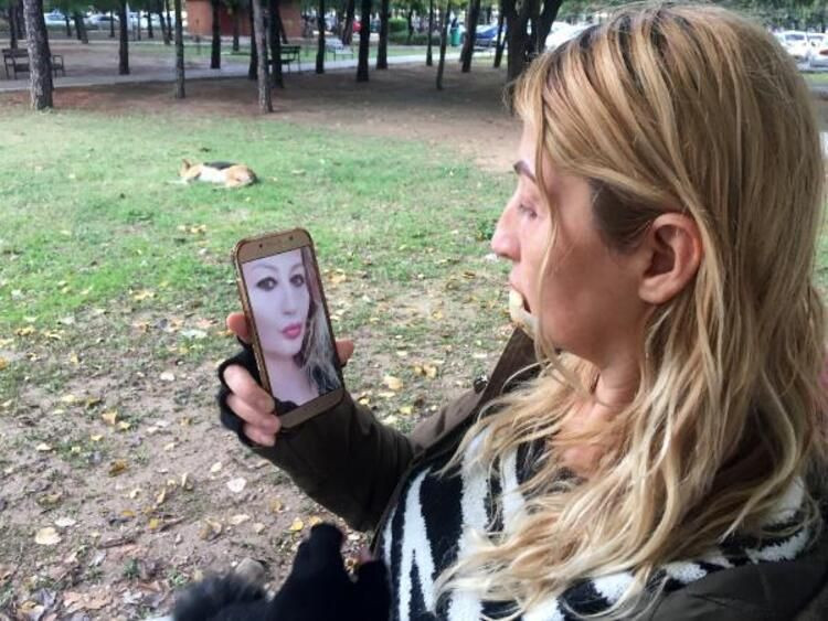 Güzellik uğruna alt dudağını kaybetti! Kötü haber geldi... - Sayfa 11