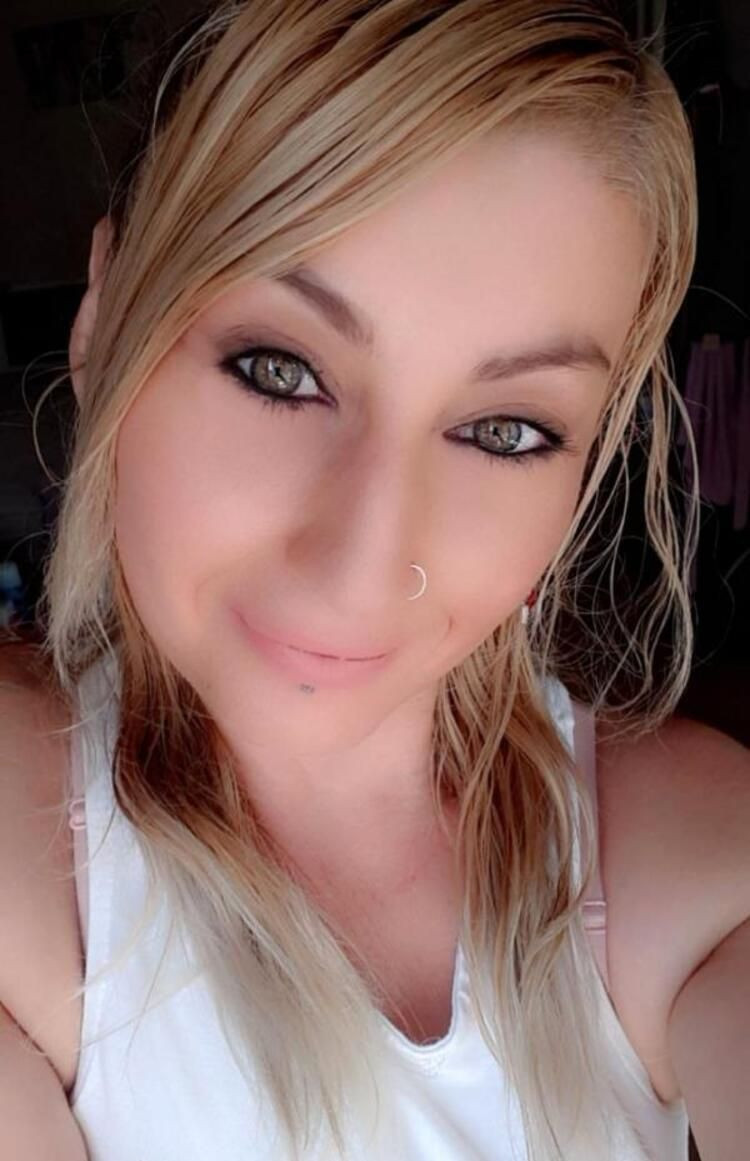 Güzellik uğruna alt dudağını kaybetti! Kötü haber geldi... - Sayfa 5