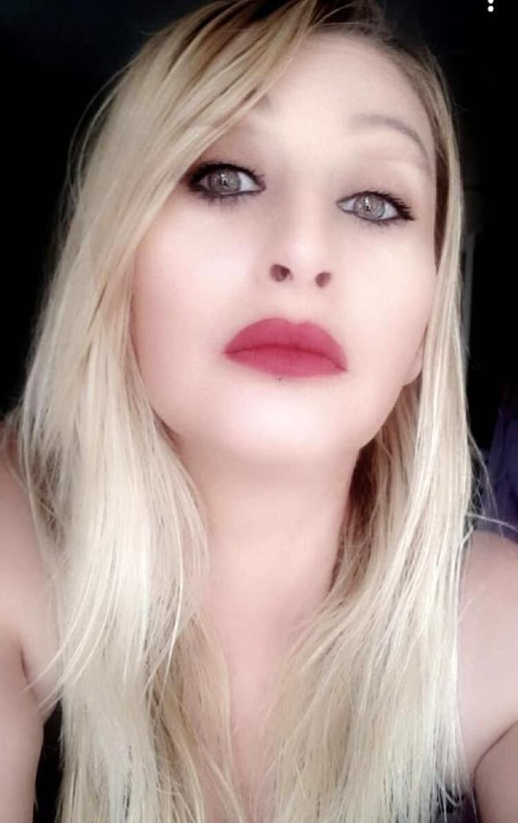 Güzellik uğruna alt dudağını kaybetti! Kötü haber geldi... - Sayfa 6