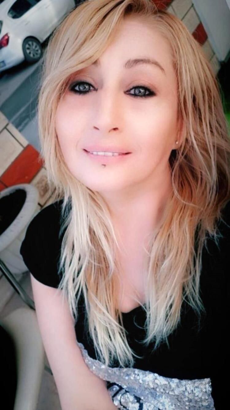 Güzellik uğruna alt dudağını kaybetti! Kötü haber geldi... - Sayfa 7