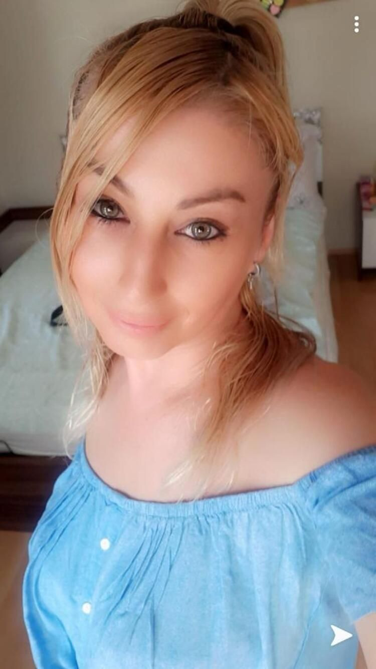 Güzellik uğruna alt dudağını kaybetti! Kötü haber geldi... - Sayfa 15