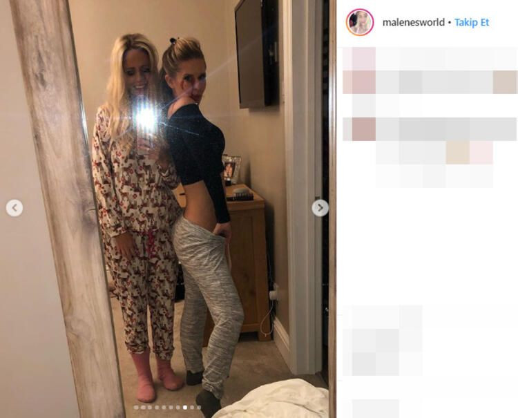 Göğüslerini büyüttü hayatı kabus oldu! - Sayfa 14