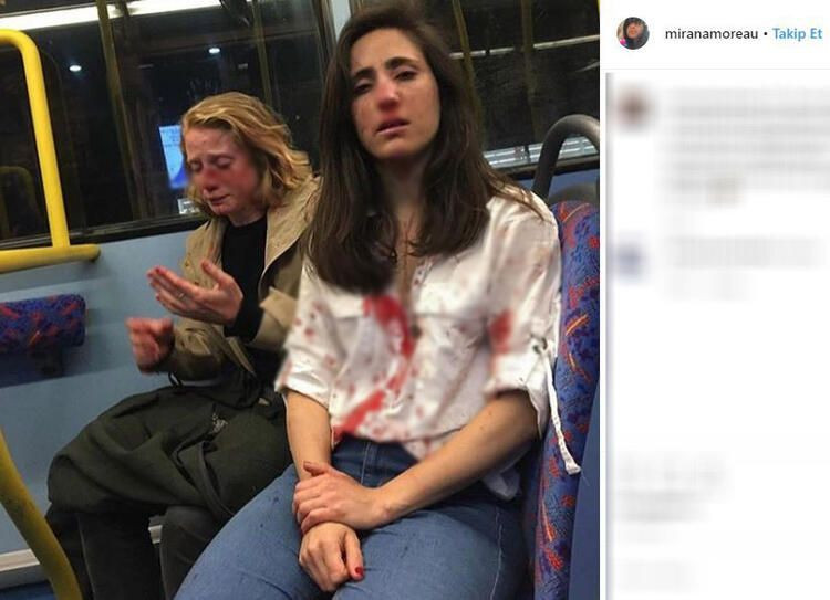 Eşcinsel kadını dövüp hastanelik ettiler! - Sayfa 10