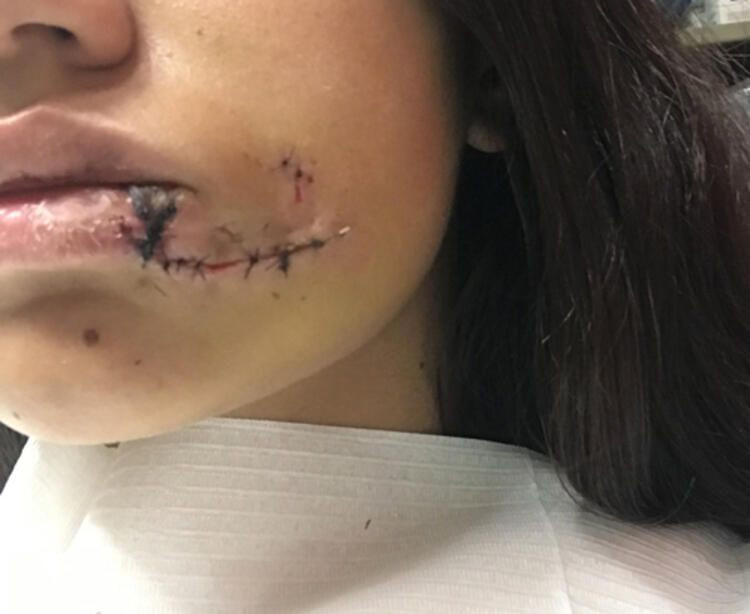 Bu sevginin 1 dakika sonrası dehşet ve 40 dikiş! - Sayfa 6