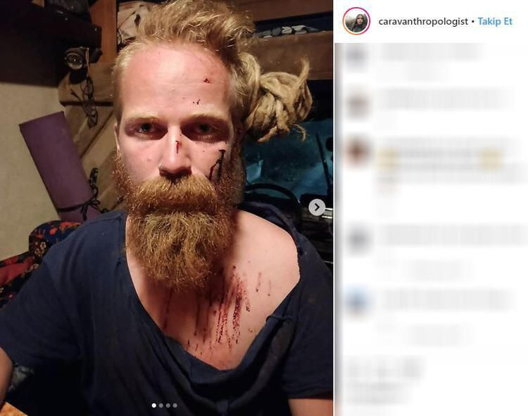 Türk kadın gezgine tecavüz çetesi saldırdı! - Sayfa 5