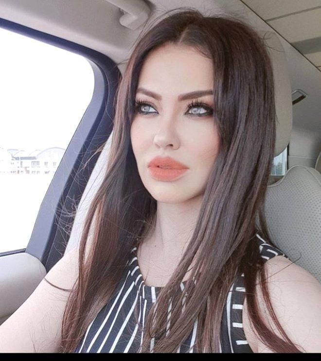 Lara'yı gören tanıyamıyor! - Sayfa 7