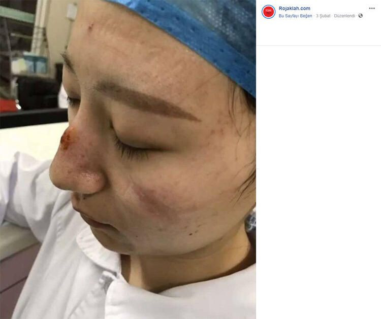 Korona izleri yüzlerinde - Sayfa 7