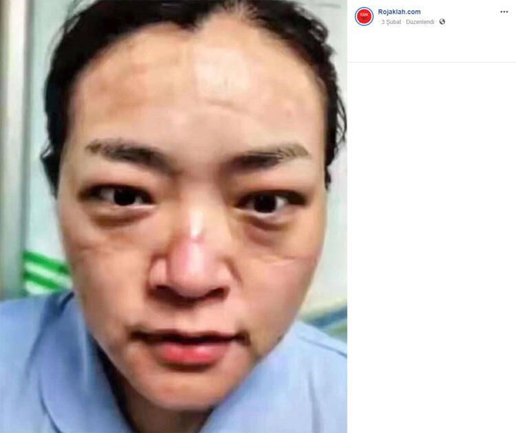 Korona izleri yüzlerinde - Sayfa 12