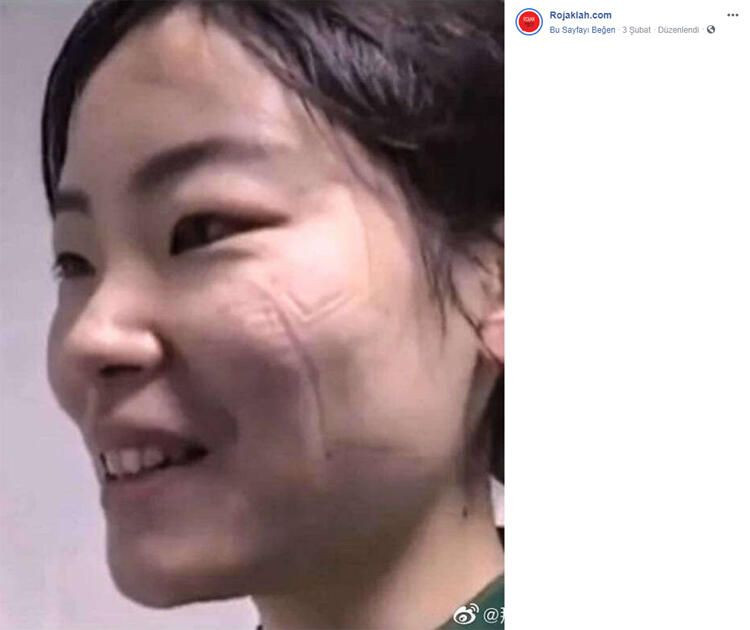 Korona izleri yüzlerinde - Sayfa 6