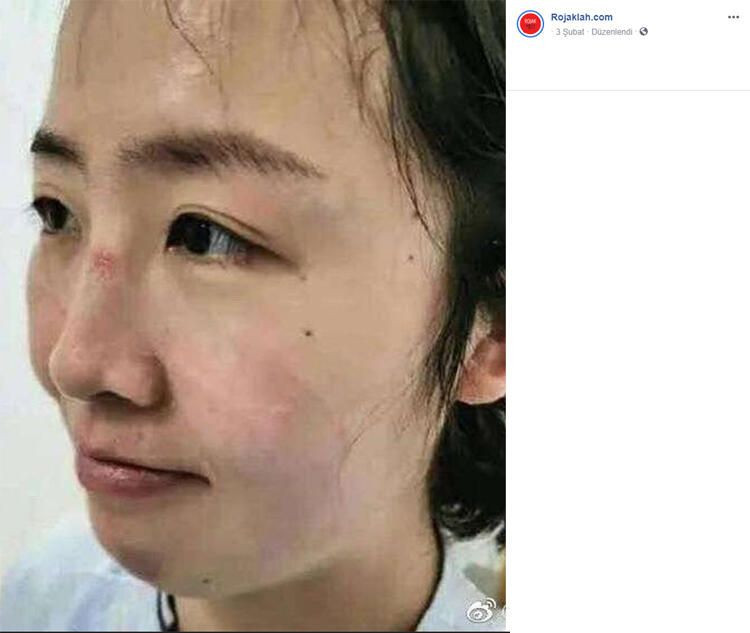 Korona izleri yüzlerinde - Sayfa 10