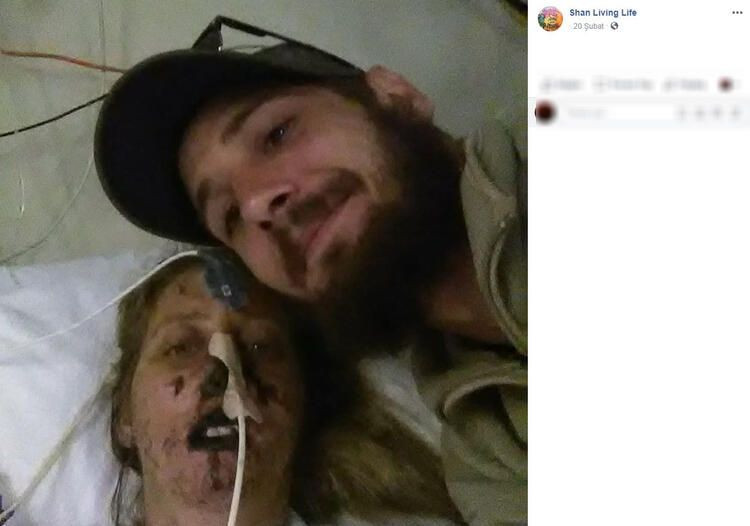 Bir ısırık 66 ameliyat! Hayatı karardı... - Sayfa 5