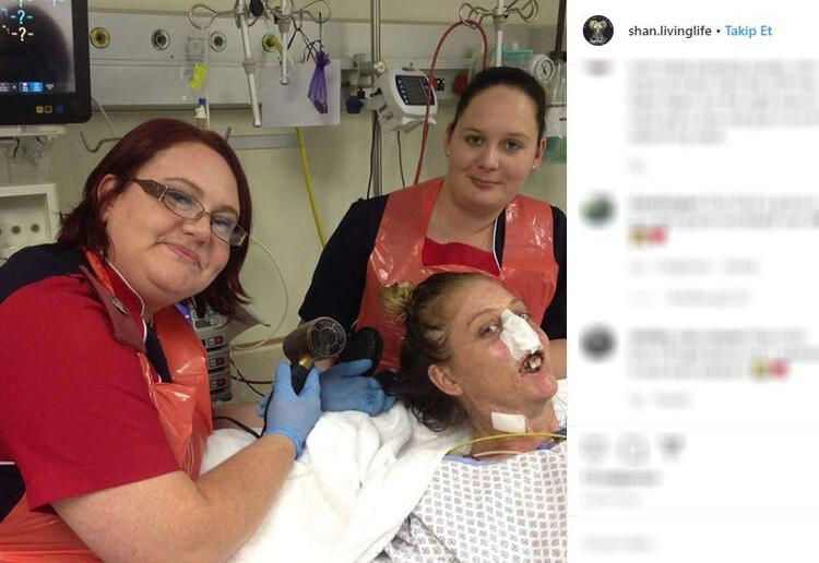 Bir ısırık 66 ameliyat! Hayatı karardı... - Sayfa 6