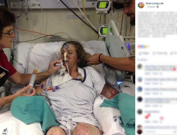 Bir ısırık 66 ameliyat! Hayatı karardı... - Sayfa 7