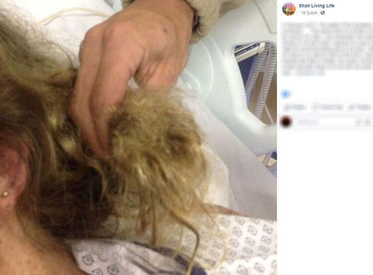 Bir ısırık 66 ameliyat! Hayatı karardı... - Sayfa 8