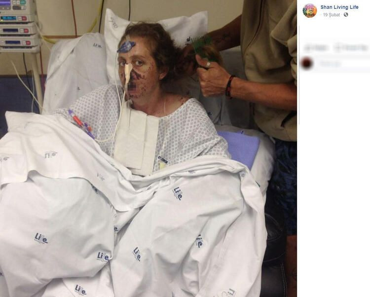 Bir ısırık 66 ameliyat! Hayatı karardı... - Sayfa 9