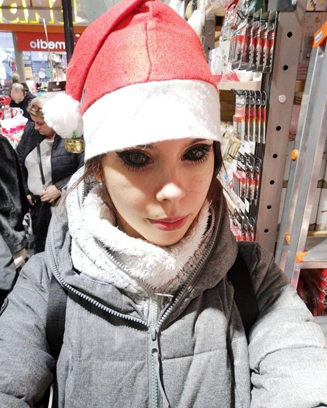 Genç modelin hayatı karardı! Korkunç halde... - Sayfa 8