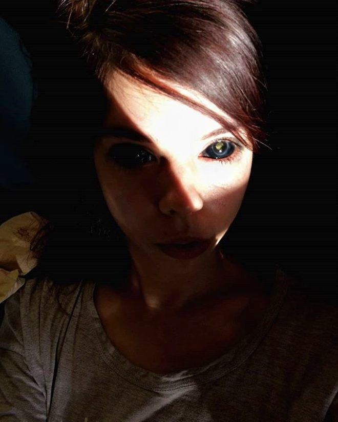 Genç modelin hayatı karardı! Korkunç halde... - Sayfa 11