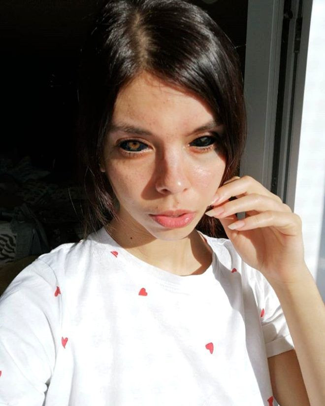 Genç modelin hayatı karardı! Korkunç halde... - Sayfa 7