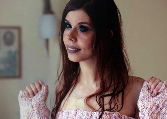 Genç modelin hayatı karardı! Korkunç halde... - Sayfa 5