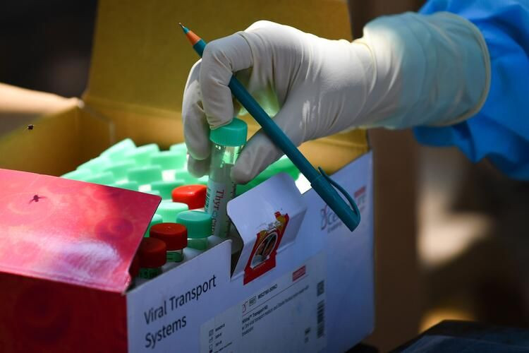 Çin'in sildiği fotoğraflar sızdı! 1500 virüs o dondurucuda saklanıyor... - Sayfa 23