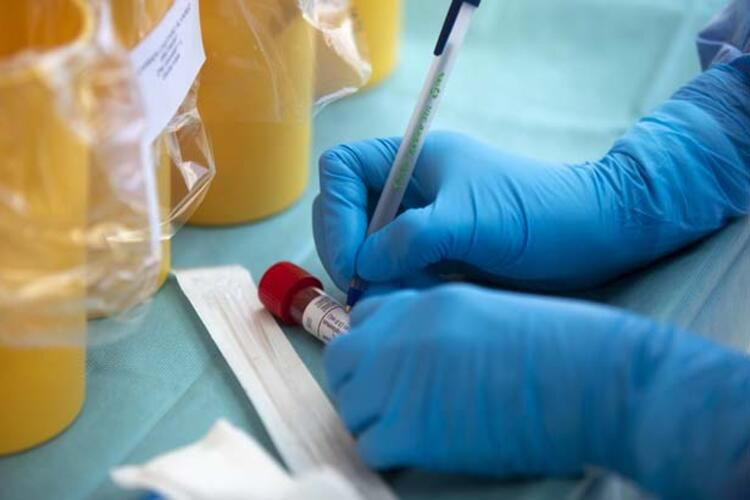 Dünya bu kelimeleri konuşuyor: Sessiz hipoksi! ABD'li doktor anlattı... - Sayfa 29