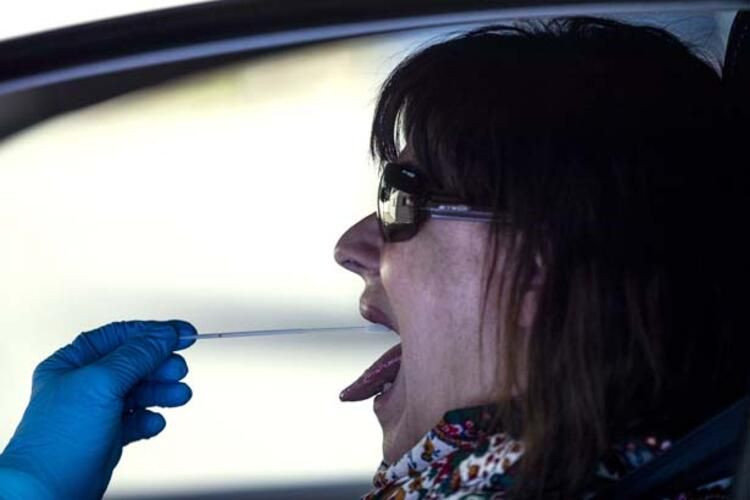 Dünya bu kelimeleri konuşuyor: Sessiz hipoksi! ABD'li doktor anlattı... - Sayfa 31