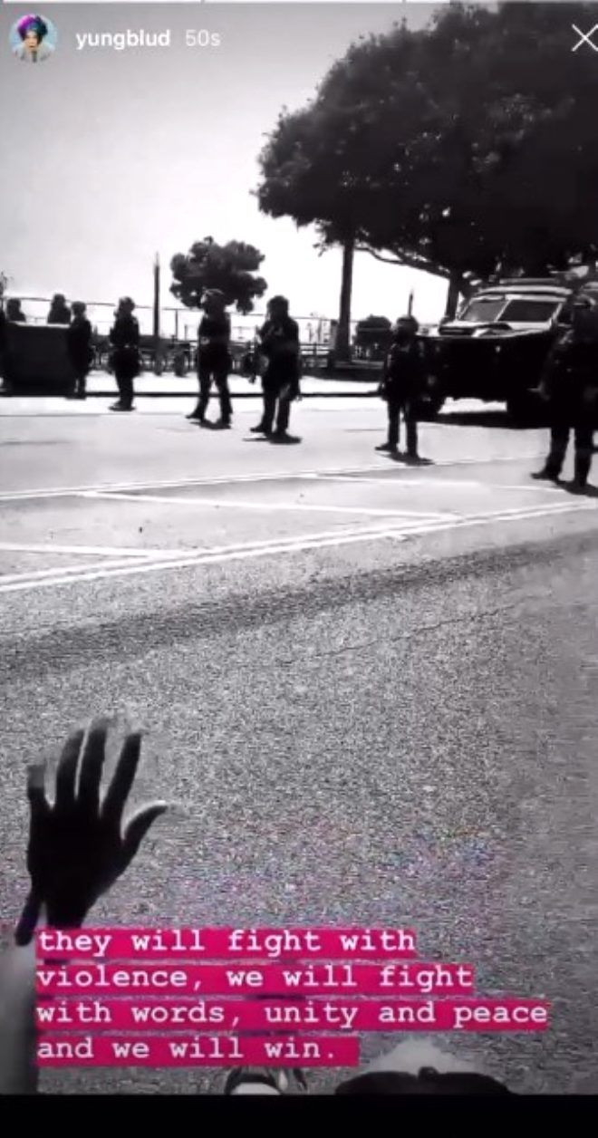 Ünlü şarkıcı Halsey, plastik mermi ile vuruldu - Sayfa 12